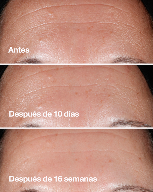 Suero Facial Antiedad Smart™ Clinical Repair Wrinkle Correcting Serum
