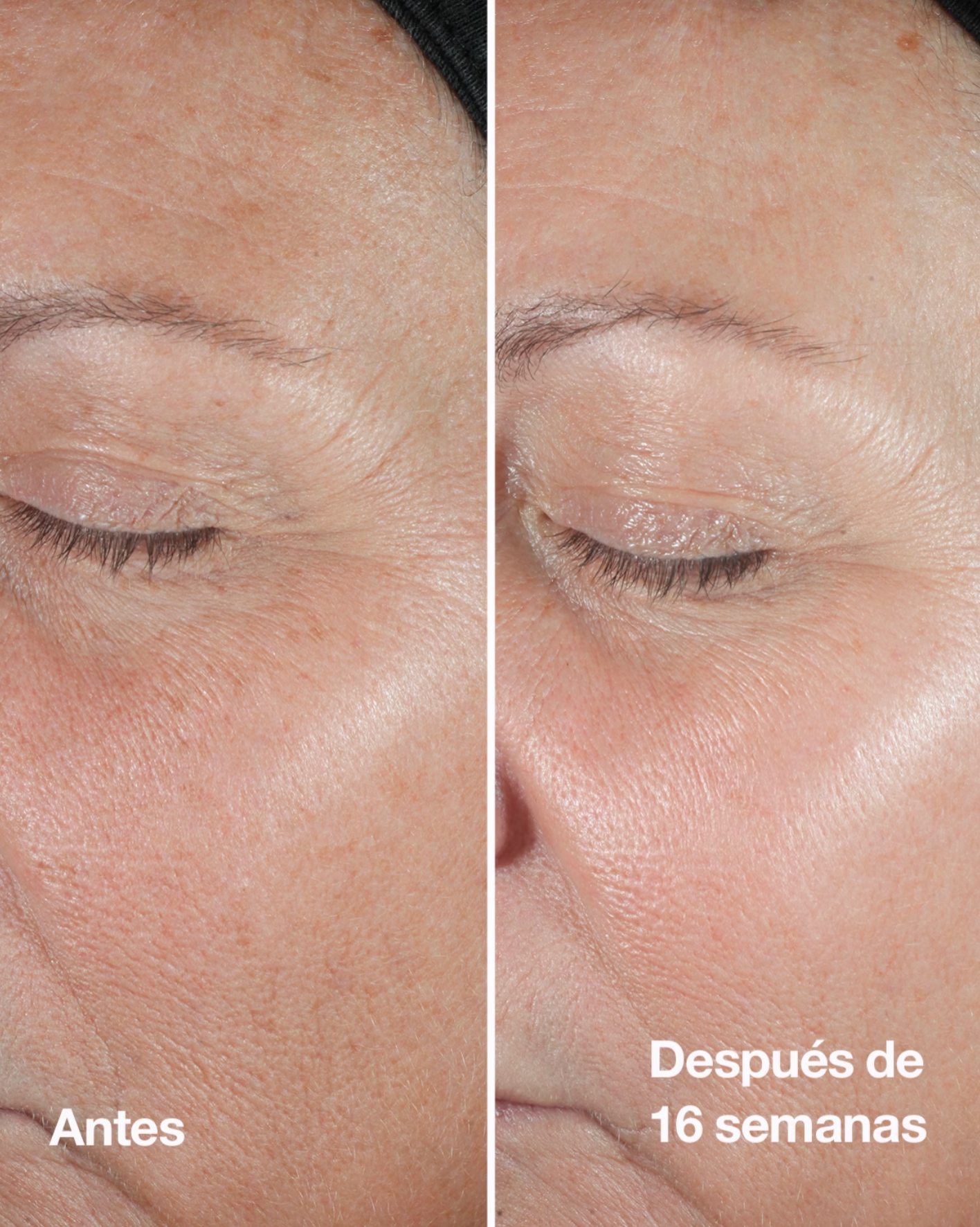 Suero Facial Antiedad Smart™ Clinical Repair Wrinkle Correcting Serum