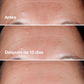 Suero Facial Antiedad Smart™ Clinical Repair Wrinkle Correcting Serum