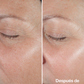 Suero Facial Antiedad Smart™ Clinical Repair Wrinkle Correcting Serum